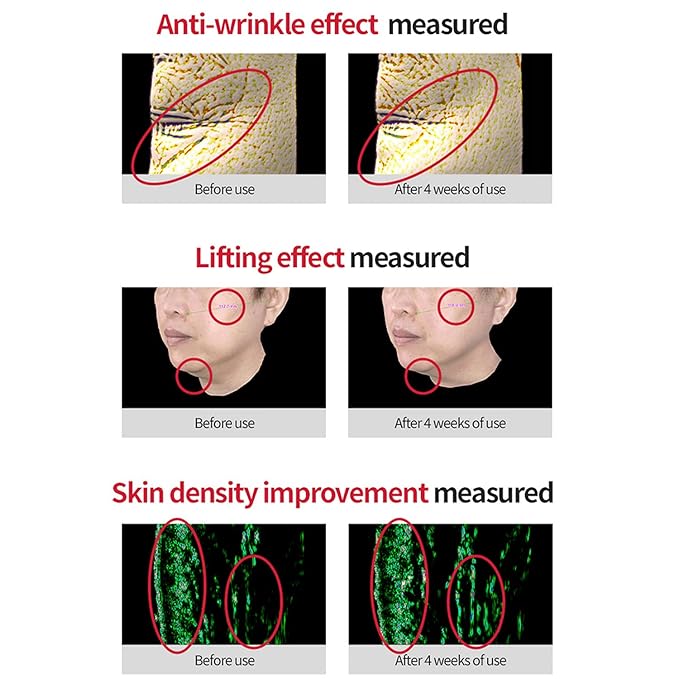 VITALIFT-A Retinal