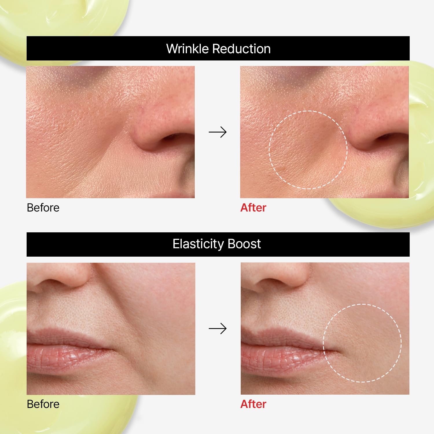 VITALIFT-A Forte Retinal